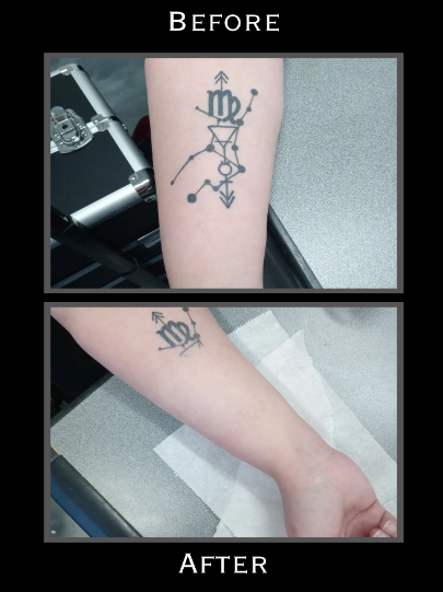 Tattoo Covering Image