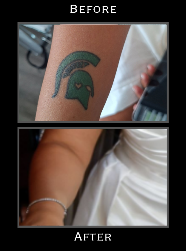 Tattoo Covering Image